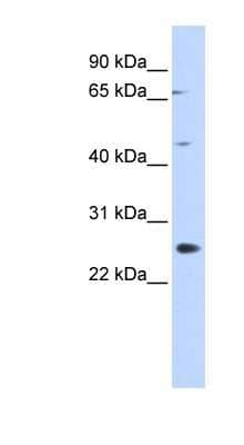 Western Blot: SPATA22 Antibody [NBP1-55225] - Titration: 0.2-1 ug/ml, Positive Control: 293T cell lysate.