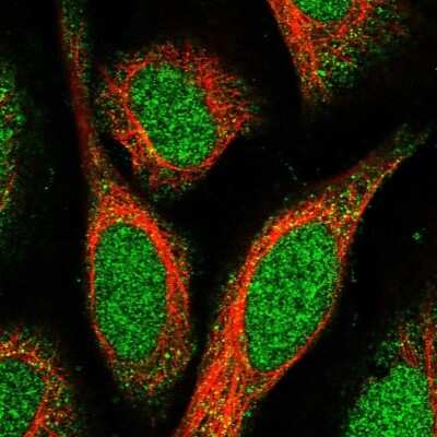 Immunocytochemistry/Immunofluorescence: SPATA24 Antibody [NBP1-92429] - Staining of human cell line U-2 OS shows localization to nucleus and cytosol.