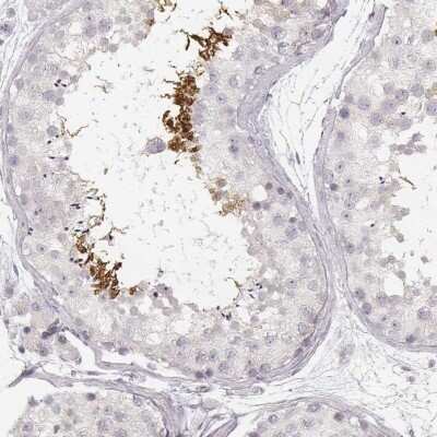 Immunohistochemistry-Paraffin: SPATA24 Antibody [NBP1-92429] - Staining of human testis shows high expression.