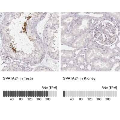 Immunohistochemistry-Paraffin: SPATA24 Antibody [NBP1-92429] - Staining in human testis and kidney tissues using anti-SPATA24 antibody. Corresponding SPATA24 RNA-seq data are presented for the same tissues.