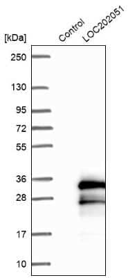 Western Blot: SPATA24 Antibody [NBP1-92429] - Analysis in control (vector only transfected HEK293T lysate) and LY403779 over-expression lysate (Co-expressed with a C-terminal myc-DDK tag (3.1 kDa) in mammalian HEK293T cells).
