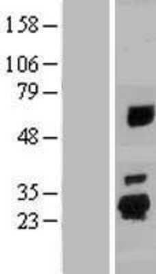 Western Blot SPATA24 Overexpression Lysate