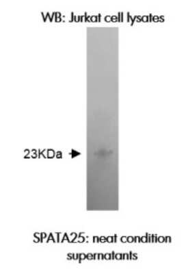 Western Blot: SPATA25 Antibody (Z37P3H11/B2) [NBP2-50305] - Western blotting was performed on Jurkat cell lysates using anti-SPATA25 [Z37P3H11 B2].