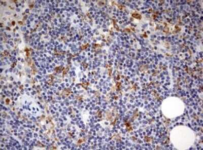 Immunohistochemistry: SPATA2L Antibody (3F6) [NBP2-45940] - Analysis of Human lymph node tissue.