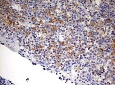 Immunohistochemistry: SPATA2L Antibody (3F6) [NBP2-45940] - Analysis of Human tonsil tissue.  Dilution: 1:150