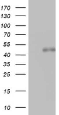 Western Blot: SPATA2L Antibody (3F6) [NBP2-45940] - Analysis of HEK293T cells were transfected with the pCMV6-ENTRY control (Left lane) or pCMV6-ENTRY SPATA2L .