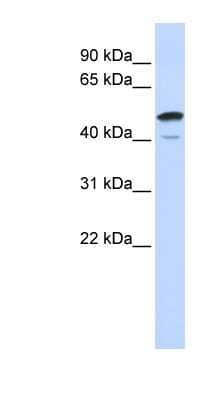 Western Blot: SPATA2L Antibody [NBP1-56681] - Fetal Brain lysate, concentration 0.2-1 ug/ml.