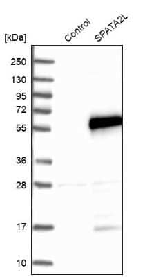 Western Blot: SPATA2L Antibody [NBP2-47265] - Analysis in control (vector only transfected HEK293T lysate) and SPATA2L over-expression lysate (Co-expressed with a C-terminal myc-DDK tag (3.1 kDa) in mammalian HEK293T cells).