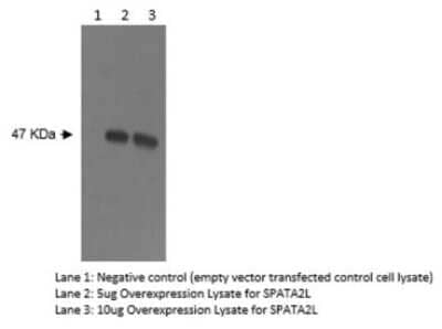 Western Blot: SPATA2L Antibody (Z2P2D5/C8) [NBP2-50306]