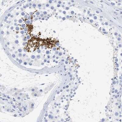 Immunohistochemistry-Paraffin SPATA3 Antibody