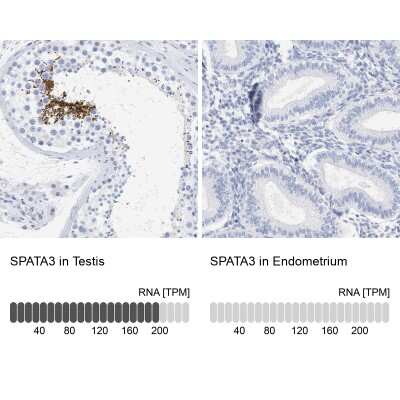 Immunohistochemistry-Paraffin SPATA3 Antibody