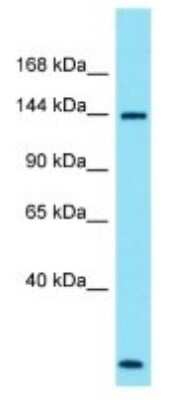 Western Blot: SPATA31A1 Antibody [NBP3-09710] - Western blot analysis of SPATA31A1 in ACHN Whole Cell lysates. Antibody dilution at 1.0ug/ml