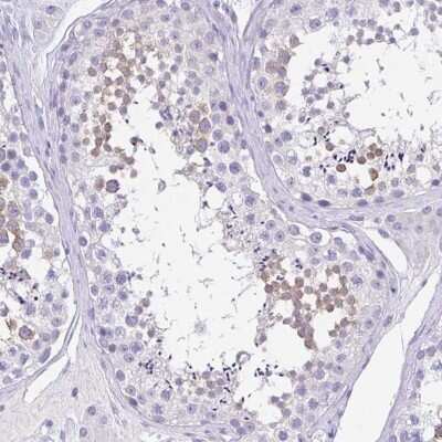 Immunohistochemistry-Paraffin: SPATA4 Antibody [NBP1-80731] - Staining of human testis shows high expression.