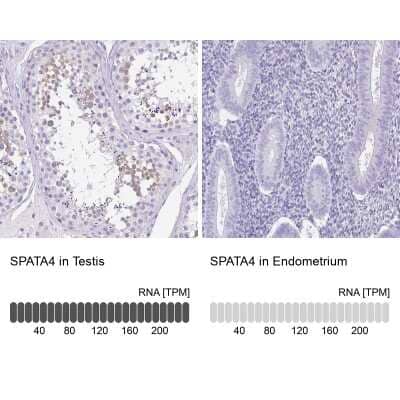 <b>Orthogonal Strategies Validation. </b>Immunohistochemistry-Paraffin: SPATA4 Antibody [NBP1-80731] - Staining in human testis and endometrium tissues using anti-SPATA4 antibody. Corresponding SPATA4 RNA-seq data are presented for the same tissues.