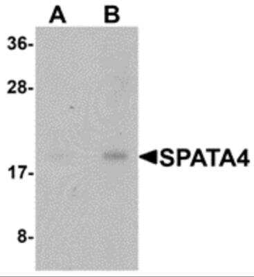 Western Blot: SPATA4 Antibody [NBP2-81852] - Analysis of SPATA4 in mouse stomach tissue lysate with SPATA4 antibody at (A) 1 and (B) 2 ug/ml.