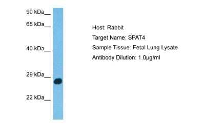 Western Blot: SPATA4 Antibody [NBP2-88344] - Host: Rabbit. Target Name: SPAT4. Sample Type: Fetal Lung lysates. Antibody Dilution: 1.0ug/ml