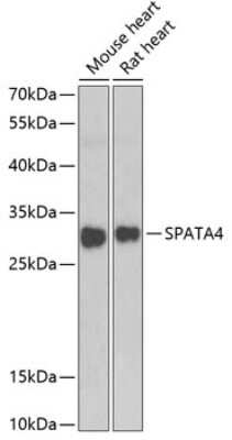 Western Blot: SPATA4 Antibody [NBP2-93377] - Analysis of extracts of various cell lines, using SPATA4 at 1:1000 dilution. Secondary antibody: HRP Goat Anti-Rabbit IgG (H+L) at 1:10000 dilution. Lysates/proteins: 25ug per lane. Blocking buffer: 3% nonfat dry milk in TBST. Detection: ECL Basic Kit . Exposure time: 90s.