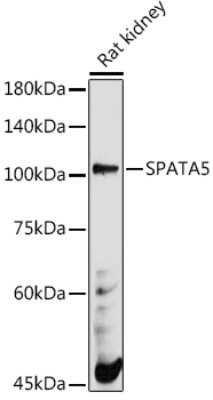 Western Blot: SPATA5 Antibody [NBP3-16028] - Western blot analysis of extracts of Rat kidney, using SPATA5 antibody (NBP3-16028) at 1:500 dilution. Secondary antibody: HRP Goat Anti-Rabbit IgG (H+L) at 1:10000 dilution. Lysates/proteins: 25ug per lane. Blocking buffer: 3% nonfat dry milk in TBST. Detection: ECL Basic Kit. Exposure time: 180s.