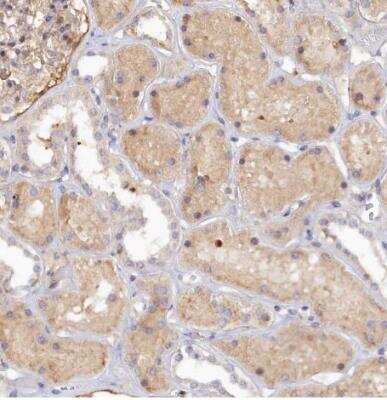 Immunohistochemistry-Paraffin: SPATA5L1 Antibody [NBP1-92430] - Staining of human kidney shows moderate nuclear positivity in a small subset of cells in tubules.