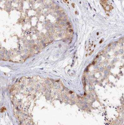 Immunohistochemistry-Paraffin: SPATA5L1 Antibody [NBP1-92430] - Staining of human testis shows moderate nuclear positivity in a small subset of cells in seminiferious ducts.