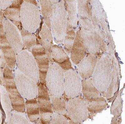 Immunohistochemistry-Paraffin: SPATA5L1 Antibody [NBP1-92430] - Staining of human skeletal muscle shows weak to moderate ctyoplasmic positivity in myocytes.