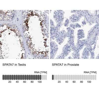 Immunohistochemistry-Paraffin: SPATA7 Antibody [NBP1-83195] - Staining in human testis and prostate tissues using anti-SPATA7 antibody. Corresponding SPATA7 RNA-seq data are presented for the same tissues.