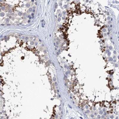 Immunohistochemistry-Paraffin: SPATA7 Antibody [NBP1-83195] - Staining of human testis shows high expression.