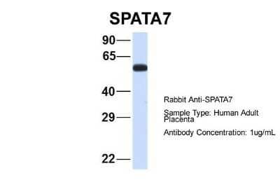 Western Blot: SPATA7 Antibody [NBP1-56884] - Sample Type: Human Adult Placenta Antibody Dilution: 1.0 ug/ml