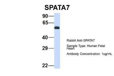 Western Blot SPATA7 Antibody