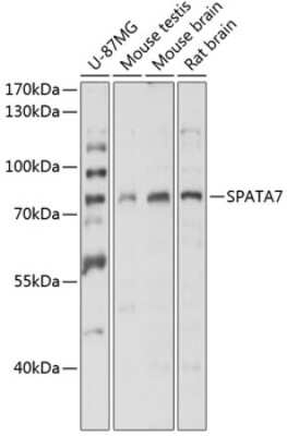 Western Blot SPATA7 Antibody - BSA Free