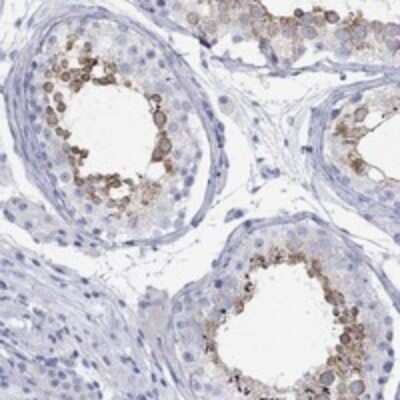 Immunohistochemistry-Paraffin: SPATA9 Antibody [NBP3-17313] - Staining of human testis shows strong cytoplasmic and membranous positivity in cells in seminiferous ducts.