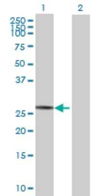 Western Blot: SPATA9 Antibody [H00083890-B01P] - Analysis of SPATA9 expression in transfected 293T cell line by SPATA9 polyclonal antibody.  Lane 1: SPATA9 transfected lysate(27.94 KDa). Lane 2: Non-transfected lysate.