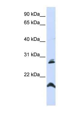 Western Blot: SPATA9 Antibody [NBP1-59460] - HepG2 cell lysate, concentration 0.2-1 ug/ml.
