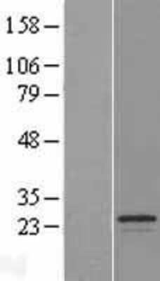 Western Blot: SPATA9 Overexpression Lysate (Adult Normal) [NBL1-16385] Left-Empty vector transfected control cell lysate (HEK293 cell lysate); Right -Over-expression Lysate for SPATA9.