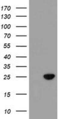 Western Blot: SPATC1L Antibody (OTI1H6) - Azide and BSA Free [NBP2-72277] - HEK293T cells were transfected with the pCMV6-ENTRY control (Left lane) or pCMV6-ENTRY C21orf56 (Right lane) cDNA for 48 hrs and lysed. Equivalent amounts of cell lysates (5 ug per lane) were separated by SDS-PAGE and immunoblotted with anti-C21orf56.