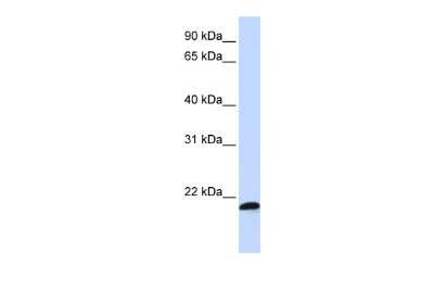 Western Blot: SPATC1L Antibody [NBP3-10591] - Western blot analysis using NBP3-10591 on Human MCF-7 as a positive control. Antibody Titration: 0.2-1 ug/ml