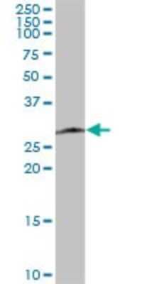 Western Blot: SPC25 Antibody [H00057405-B01P] - Analysis of SPC25 expression in human kidney.