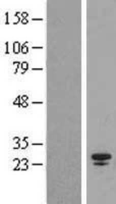 Western Blot: SPC25 Overexpression Lysate (Adult Normal) [NBL1-16387] Left-Empty vector transfected control cell lysate (HEK293 cell lysate); Right -Over-expression Lysate for SPC25.