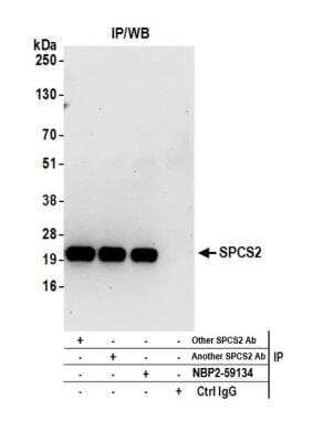 Immunoprecipitation: SPCS2 Antibody [NBP2-59134] - Detection of human SPCS2 by western blot of immunoprecipitates. Samples: Whole cell lysate (0.5 or 1.0 mg per IP reaction; 20% of IP loaded) from 293T cells prepared using NETN lysis buffer. Antibodies: Affinity purified rabbit anti-SPCS2 antibody NBP2-59134 used for IP at 20 ul per reaction. SPCS2 was also immunoprecipitated by two other rabbit anti-SPCS2 antibodies. For blotting immunoprecipitated SPCS2, NBP2-59134 was used at 1:250. Detection: Chemiluminescence with an exposure time of 30 seconds.