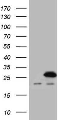 Western Blot: SPCS2 Antibody (OTI1E4) - Azide and BSA Free [NBP2-74312] - Analysis of HEK293T cells were transfected with the pCMV6-ENTRY control (Left lane) or pCMV6-ENTRY SPCS2.