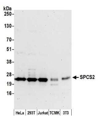 Western Blot: SPCS2 Antibody [NBP2-59134] - Detection of human and mouse SPCS2 by western blot. Samples: Whole cell lysate (50 ug) from HeLa, 293T, Jurkat, mouse TCMK-1, and mouse NIH3T3 cells prepared using NETN lysis buffer. Antibody: Affinity purified rabbit anti-SPCS2 antibody NBP2-59134 used for WB at 1:1000. Detection: Chemiluminescence with an exposure time of 30 seconds.