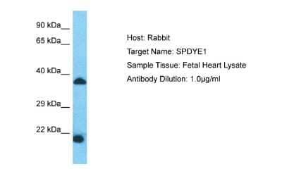 Western Blot: SPDYE1 Antibody [NBP2-83585] - Host: Rabbit. Target Name: SPDYE1. Sample Type: Fetal Heart lysates. Antibody Dilution: 1.0ug/ml