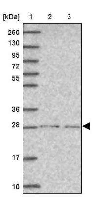 Western Blot: SPDYE1 Antibody [NBP2-46794] - Lane 1: Marker [kDa] 250, 130, 95, 72, 55, 36, 28, 17, 10, Lane 2: Human cell line RT-4, Lane 3: Human cell line U-251 MG