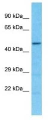 Western Blot: SPDYE2B Antibody [NBP3-09890] - Western blot analysis of SPDYE2B in Hela Whole Cell lysates. Antibody dilution at 1.0ug/ml