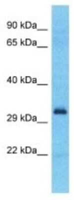 Western Blot: SPDYE2B Antibody [NBP3-09891] - Western blot analysis of SPDYE2B in MCF7 Whole Cell lysates. Antibody dilution at 1.0ug/ml