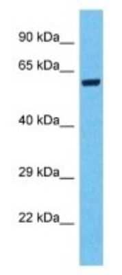 Western Blot: SPDYE3 Antibody [NBP3-09913] - Western blot analysis of SPDYE3 in Hela Whole Cell lysates. Antibody dilution at 1.0ug/ml
