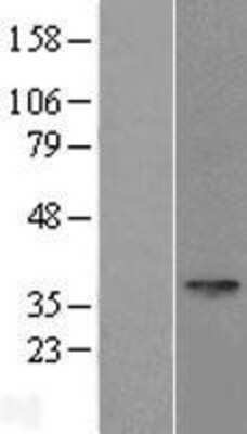 Western Blot: SPEM1 Overexpression Lysate (Adult Normal) [NBL1-16392] Left-Empty vector transfected control cell lysate (HEK293 cell lysate); Right -Over-expression Lysate for SPEM1.