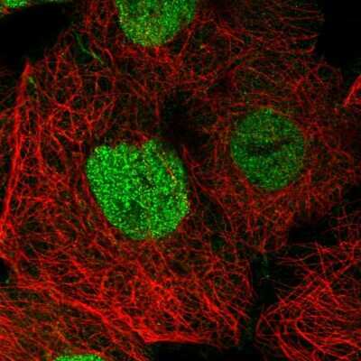 Immunocytochemistry/ Immunofluorescence SPEN Antibody - BSA Free