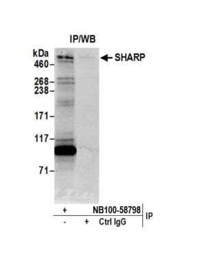 Immunoprecipitation: SPEN Antibody [NB100-58798] - Detection of human SHARP by western blot of immunoprecipitates. Samples: Whole cell lysate (0.5 or 1.0 mg per IP reaction; 20% of IP loaded) from HeLa cells prepared using NETN lysis buffer. Antibodies: Affinity purified rabbit anti-SHARP antibody NB100-58798 used for IP at 6 ug per reaction. For blotting immunoprecipitated SHARP, NB100-58798 was used at 1 ug/ml. Detection: Chemiluminescence with an exposure time of 30 seconds.