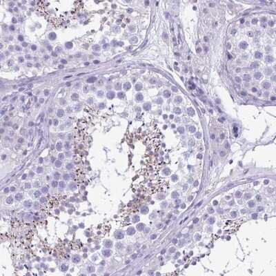 Immunohistochemistry-Paraffin: SPERT Antibody [NBP1-86592] - Staining of human testis shows high expression.